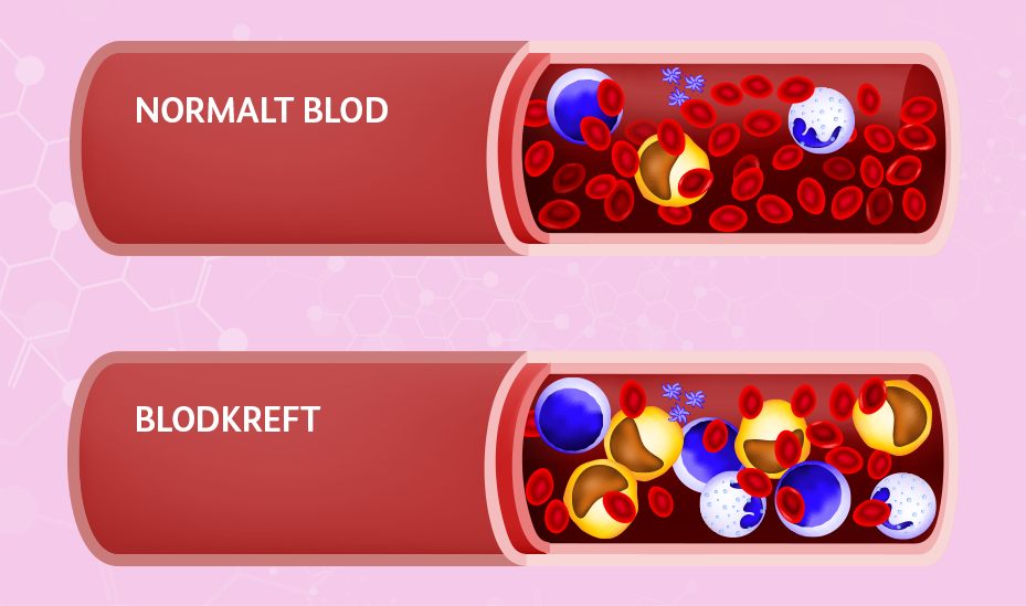 Blodkreft